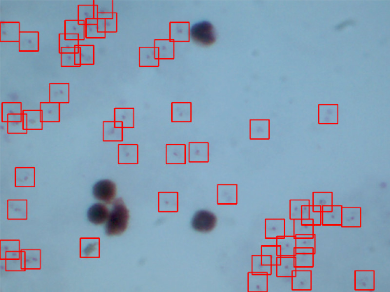 Detection of plasmodium