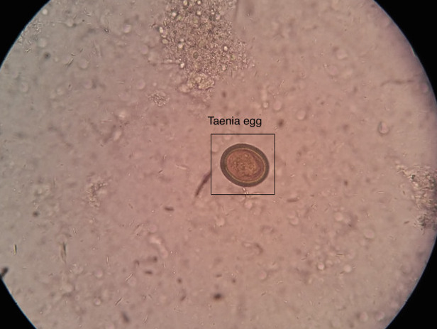 Taenia egg